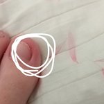 [댓글부탁해] 발톱 너무 둥글고 잛게깎아서 <b>내성</b>발톱