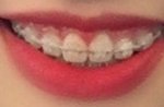 나 웃을때 <b>잇몸</b> 보여