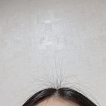 [댓글부탁해] 정수리 <b>잡초</b> 어케 못 하냐 __