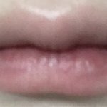 [이것좀봐줘] 입술<b>필러</b>가 하고싶어 조언 부탁해