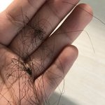 [댓글부탁해] ㅅㅂ나 <b>탈모</b>냐