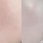 [드루와] 인생 피부 됨