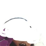 교정 전후/장단점
