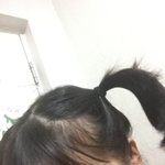판녀는 다 좋은데 <b>탈모야</b>ㅠㅠㅠ