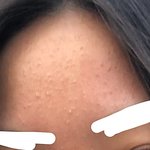 [드루와] 지성들아 좁쌀 박멸법 알려줄게 전후사진ㅇ