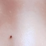 [이것좀봐줘] 완전절개 쌍수 두<b>달째</b>인데 ....