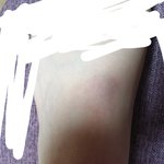 [댓글부탁해] 나 발 상태 어제보다 심각한것같지