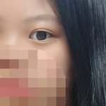 [댓글부탁해] <b>쌍테</b>로 쌍꺼풀라인 바꿨는데 많이 티남?