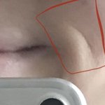 얘들아 이거 <b>주름</b>이야,,??