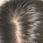 나 <b>탈모</b> 같아?? (사진있음)