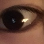 얘둘아 너네라면 <b>재수술</b>할래???쌍수