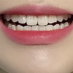 <b>이빨</b> 자라는 방법좀 알려줘