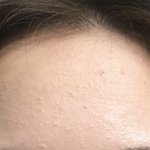 이정도 <b>좁쌀</b>이면 앞머리 까고 댕기는 거