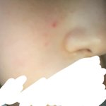 피부에 일케 머ㅓ가 자꾸 나는데