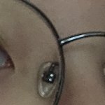 [뷰티톡] 쌍수2개월차야ㅜㅜ 눈어땡?
