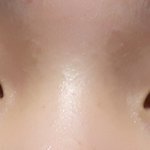 [드루와] <b>쌍테</b> 1.2달차 <b>쌍</b>커풀생김