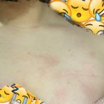 [댓글부탁해] 샤워 할 때 <b>마다</b> 맨날 저렇게 됨 왜그래?