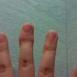 나만큼 손가락 <b>기형</b>인 사람 있나 혹쉬