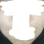 나의 애<b>깅이</b>같은 피부!!!!