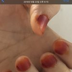 [드루와] 나 코로나때매 <b>손톱</b> 변화 ㄹㅇ대박임ㅋㅋㅋㅋㅋㅋ
