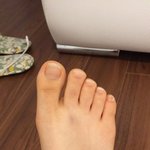 동생이랑 장난치다 <b>발가락</b>이 꺾였는데