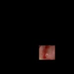 얘들아 나 <b>입안</b>에서 자꾸 피가나 사진있어ㅜ