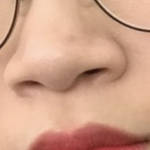 내 코성형 <b>비포</b>애프터 개쩐다