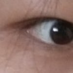 [댓글부탁해] 나 쌍수하면 <b>꼬막</b> 해결될까