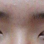 [댓글부탁해] 쌍수 <b>전후</b> 어떰