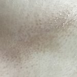 [드루와] 약혐 <b>가슴밑</b>에 긁어서 생긴 흉터 어케없앰