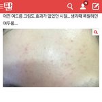 [ㅈㄱㄴ] 물 마시는거 여드름에 도움 된다는거 ㄹㅇ <b>팩트</b>인게