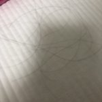 나 탈모 맞는거같냐?