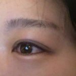 나 쌍수붓기 오떤거 같음