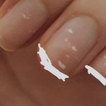 [댓글부탁해] 나는 <b>손톱</b>에 흰줄 징그러울 정도로 많음...