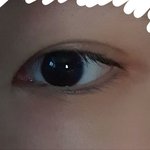 나 <b>쌍수티</b> 1도 안 나