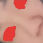 [댓글부탁해] 얘들아 나 코수술 할 까말까?