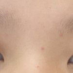나 코좀 봐주라 ㅠㅠ