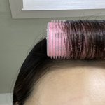 자고일어나면 <b>상처</b>가 생겨
