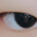 나 쌍수할때 앞트임 해야돼?