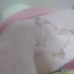 휴 수술<b>완료</b> !!!