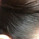 [드루와] 혐)얘들아 이런 <b>비듬</b> 왜 생기는거야..?ㅠㅠ