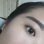 눈 아픔 ㅠㅠ 제발 알려줘