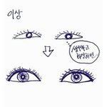 나 쌍수망했을 때