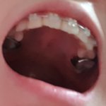 나 교정하는데 지금 이게 제일 무서움