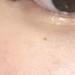 얘들아 눈 <b>밑점</b> 뺄까