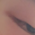 [ㅈㄱㄴ] 혐×) 나 눈에 다래끼 났음 ㅋㅌㅋㅋㅋ
