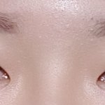 <b>눈살</b>개많은데 쌍수성공ㄱㄴ..?