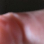 얘들아 나 <b>눈살</b> 때문에 눈 차이 좀 봐봐ㅠㅠㅠ
