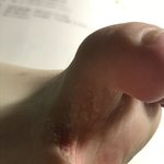 얘들아 나 <b>발가락</b> 사이 왜 이럼?