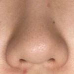 [드루와] 광고!!아니라고!!!!!)3일만에 여드름 박살냈다 와드박고가렴...